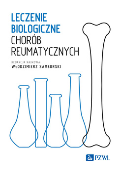 Leczenie biologiczne chorób reumatycznych