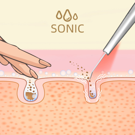 Peeling kawitacyjny 5w1 LUMINEO mega zestaw