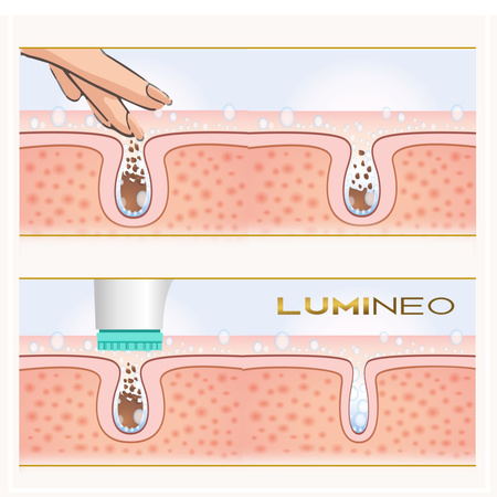 Szczoteczka Brush Pro LUMINEO 4 końcówki + żel do wszystkich rodzajów skóry turkusowa